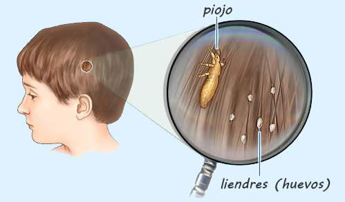 Beauty Style Peinilla de Piojos o Liendres en Metal con Mango 0618507