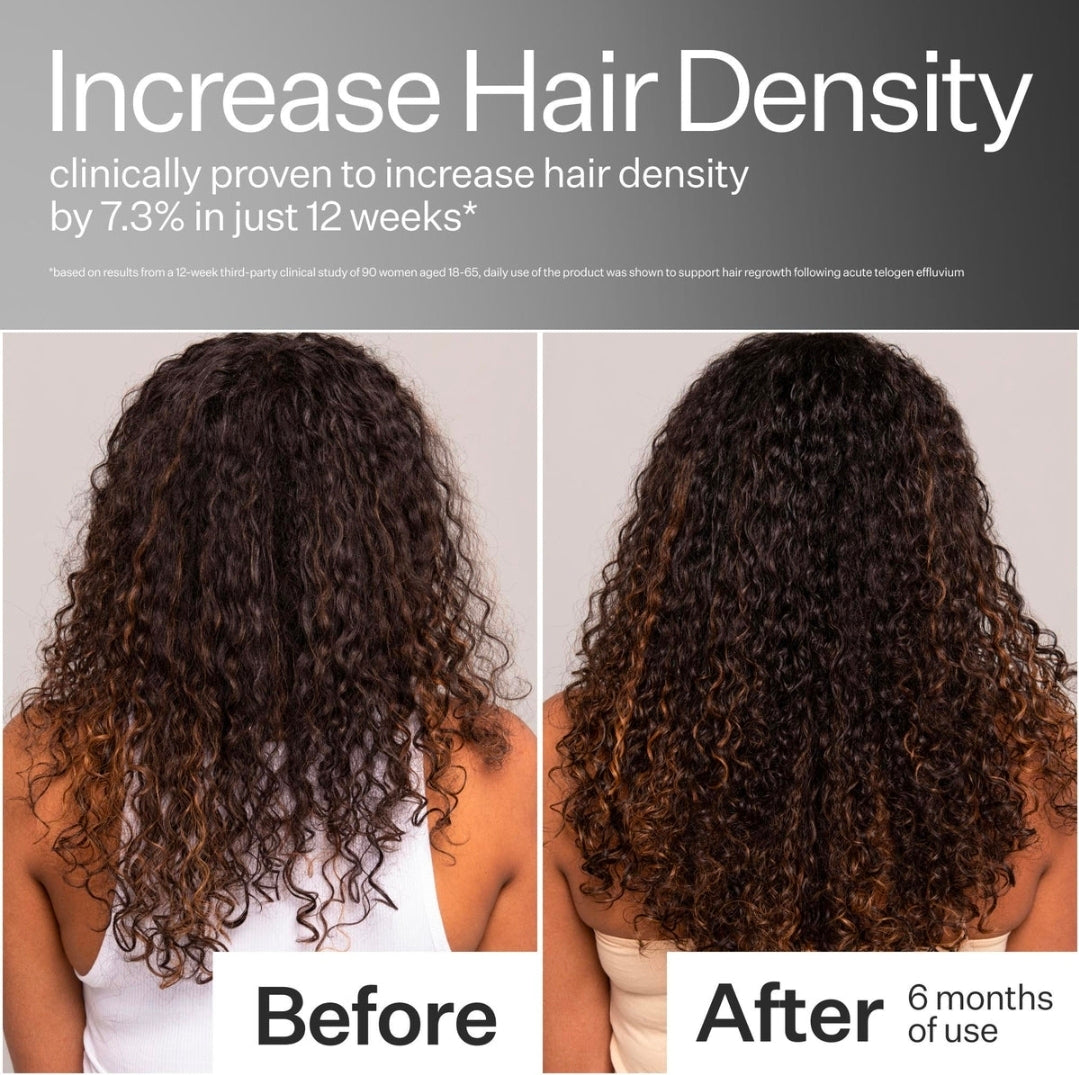 Regeneración Capilar Avanzada