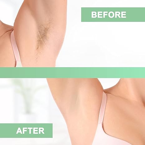 Beauty Style Banda para Depilar x 100 0586260