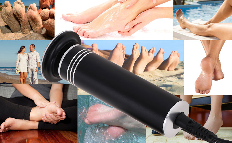 Beauty Style Removedor de Callos Eléctrico – Modelo 0900408