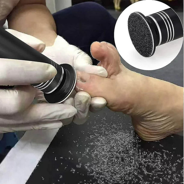 Beauty Style Removedor de Callos Eléctrico – Modelo 0900408