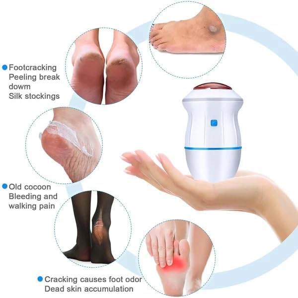 Beauty Style Máquina Removedora de Callos Recargable – Modelo 0900486