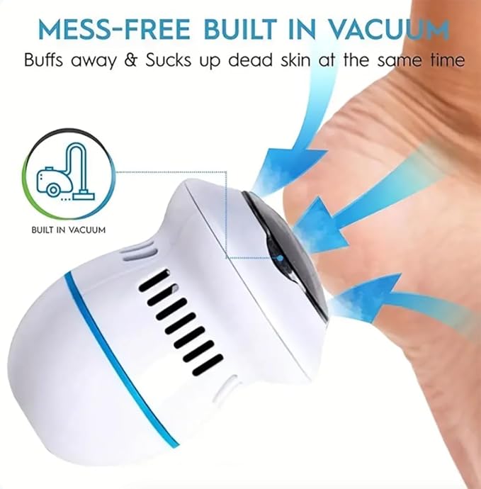 Beauty Style Máquina Removedora de Callos Recargable – Modelo 0900486