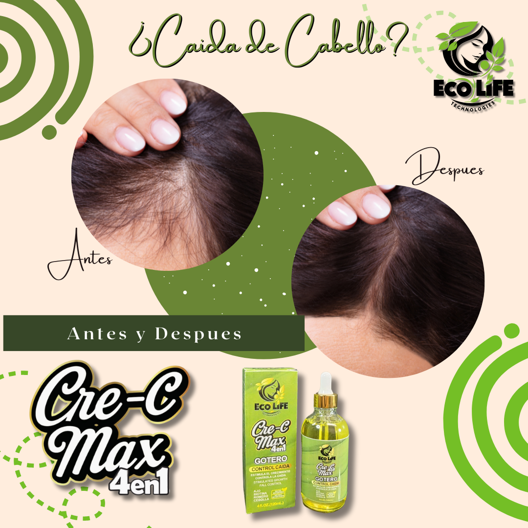 💚 Ecolife Technologies Cre-C Max 4 en 1 Gotero Anticaída 4 oz (ETCM4N1GA) – Estimula el Crecimiento y Fortalece el Cabello