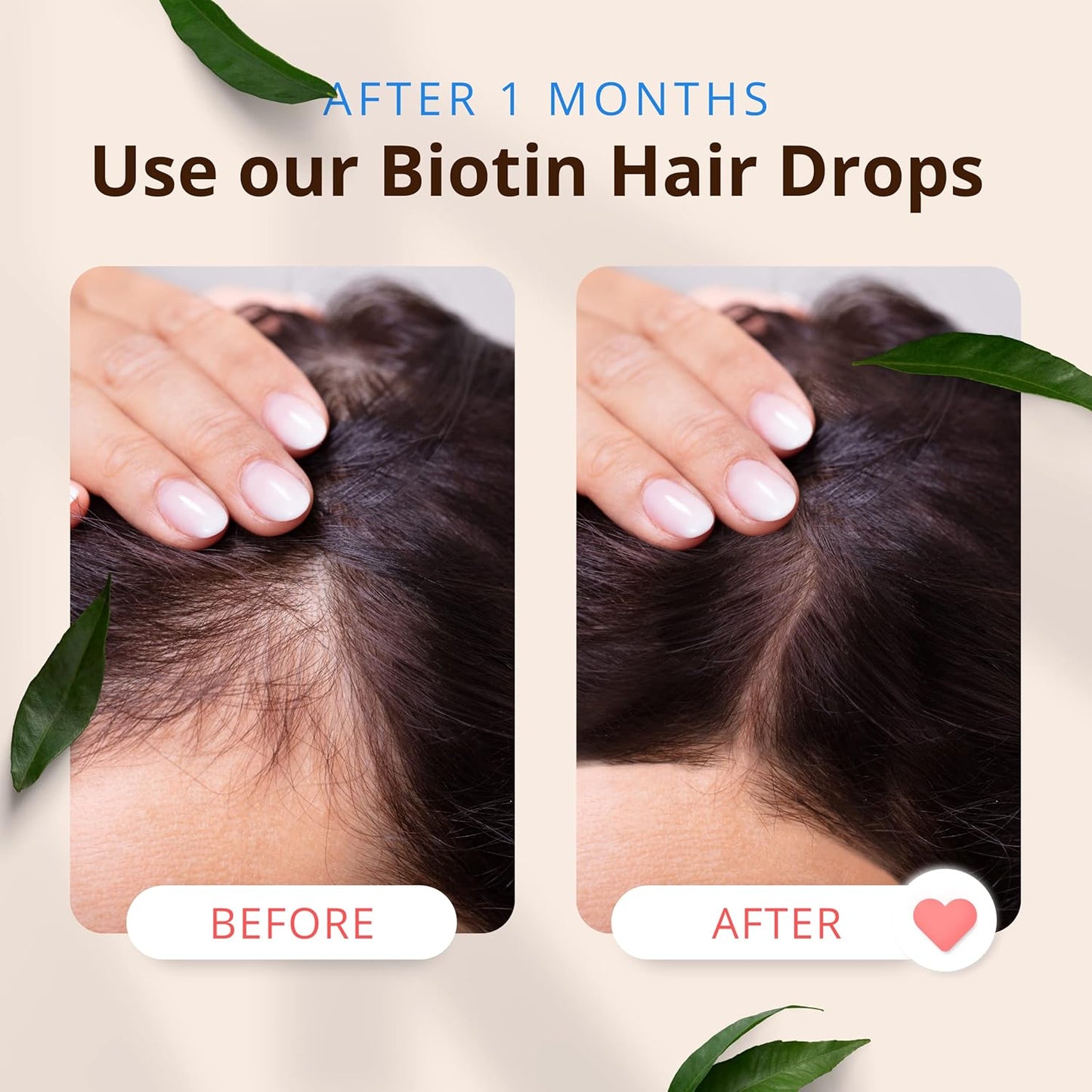 MORFOSE PROFESSIONAL BIOTIN HAIR KIT 3PC – Shampoo 500ml + Hair Mask 250ml + Two Phase Conditioner 7.4oz (MBHK3)
