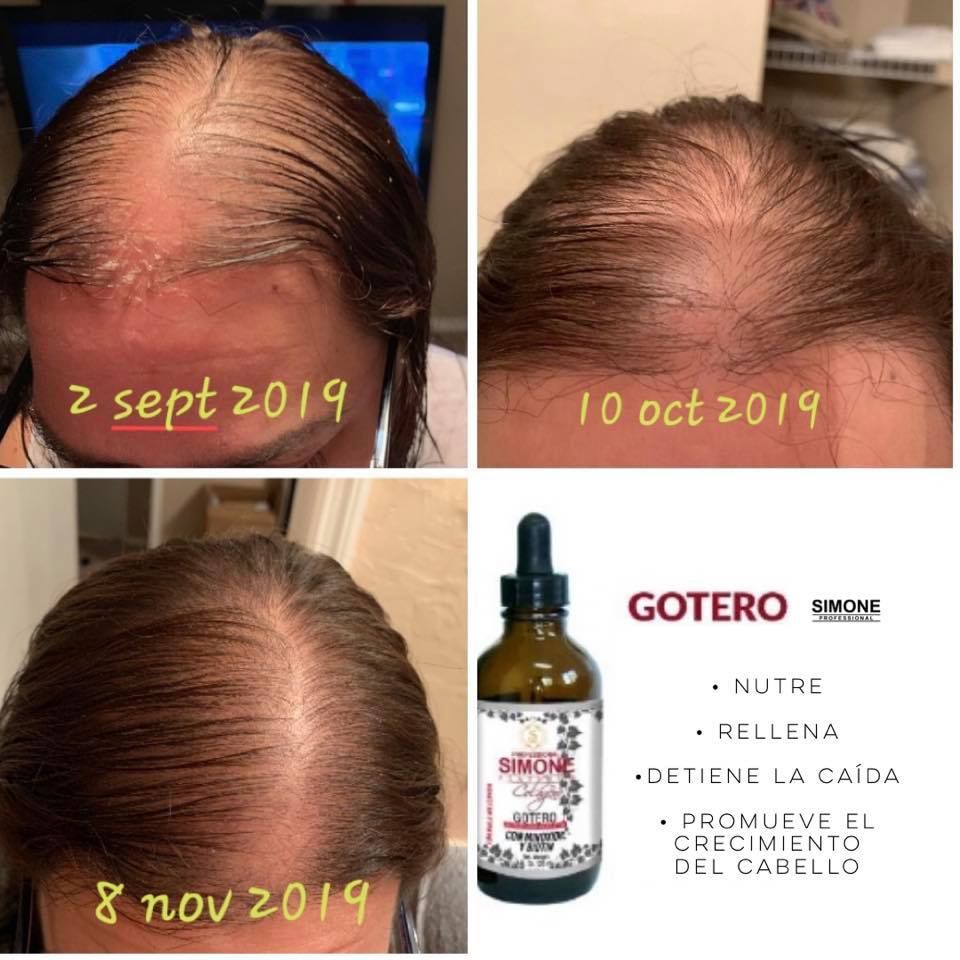 💜 SIMONE PROFESSIONAL COLÁGENO – GOTERO ANTI CAÍDA 4OZ