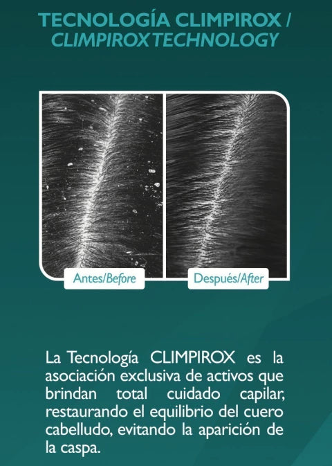 KAREOL ANTICASPA KIT 2PC SHAMPOO Y LEAVE IN DE 10.1OZ 389090300